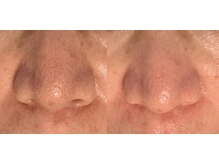 美肌ワークス(美肌works)/効果抜群毛穴ケアお任せください