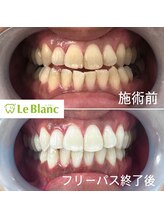 ルブラン 奈良店(Le Blanc)/男性も白い歯でかっこよく♪