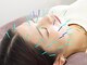 あすか鍼灸整骨院 アスカボディファクトリー(ASUKABodyFactory)の写真/若々しい印象と小顔へ導く！速攻小顔&リフトUPに感動♪初めての方もオススメ◎鏡を見るのが楽しみに♪