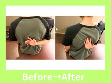 こころ整骨院/20代男性のビフォーアフター