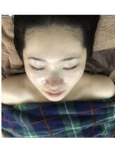 アルページュ(Arpege)/glassスキン発光小顔^_^