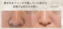 アミュレット(AMULET)