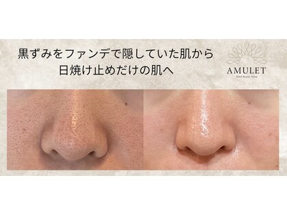 アミュレット(AMULET)の写真