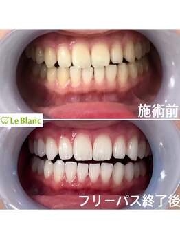 ルブラン 奈良店(Le Blanc)/日々効果実感！！