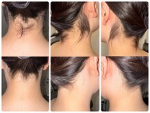ワイズサロン(Y's salon)/うなじ脱毛