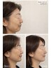 【肌を育てる】大人の肌質改善フェイシャル