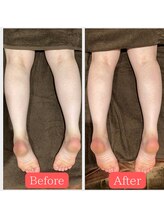 グロウ トータルビューティデザイン(GLOW TOTAL BEAUTY DESIGN)/オイルフットケア