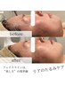 【疲れ顔・たるみ】冷房むくみもリセット◎自信あふれる笑顔へ！¥9500→¥7200