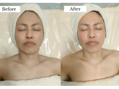 セレニテ(Serenite)の写真