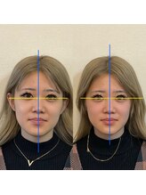 メディピークス/