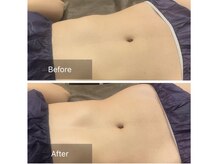 salon SUI 祐天寺【スウェディッシュマッサージ/美容整体/首肩こり頭痛】/スウェディシュストーン