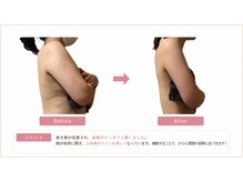 ヨサパーク ゴールデンツリー 浦安本店(YOSA PARK GordenTree)の雰囲気（20～40代女性からの口コミ多数♪高評価★4.8痩身/リンパ/小顔）
