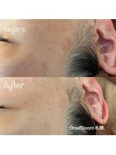 ワンブルーム(OneBloom)/ピンポイントでシミ集中ケア！