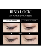 アイリー(i’rry)/バインドロックは持続力が圧倒的