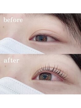 ソルテ(Sorte)/【瞼のリフトアップ♪】