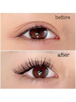 リスタ(RESTA)/バインドロック