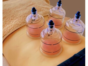 ティティビューティ ラ・クエージ金山(TTBeauty)/カッピング痩身が人気♪