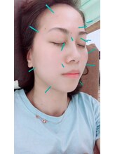 養心堂鍼灸院/美容鍼+もみほぐし