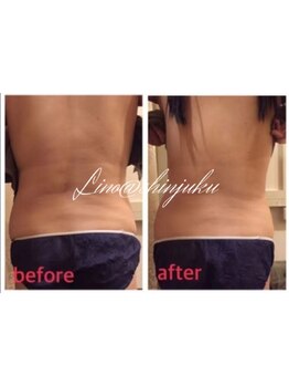 サイズダウンを目指したい