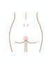 女性デリケートゾーンOライン脱毛１回