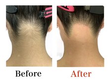 ブリリアンス(BRILLIANCE)/★うなじＷＡＸ　¥3，300★