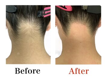 ブリリアンス(BRILLIANCE)/★うなじＷＡＸ　¥3，300★