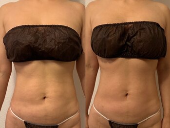 グランディール(GRANDIR)/上半身コース1回