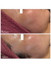 アイリアン(AiLien)/敏感肌さんにもオススメ◎