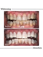 シュシュ(chouchou)/医療提携機関ジェル比較