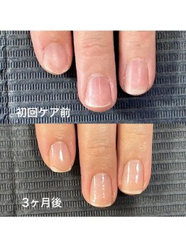 ネイルサロンアンドスクール マルベリー(mulberry)/江南市|自爪育成