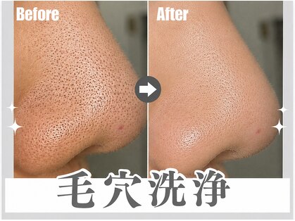 エクロール(E'clore)の写真