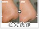 エクロール(E'clore)の写真