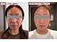 アスエ(ASUE)の写真/気になる部分を集中ケア◎韓国最新・美容液導入で、輝くツヤ肌体験をぜひ♪