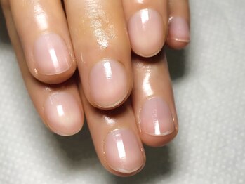 バンキッシュ(Vanquish)/ケアコース