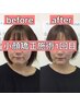 《女性ご新規》オーダーメイド小顔矯正＋造顔マッサージ100分 ¥14300→¥9800