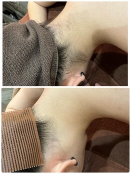 ヘアーメイク デビュー(Hair Make Debut)/えりあし脱毛