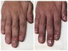 【男性/ハンド】丸爪・貝爪の自爪育成/初回体験　￥22000→