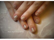 プラウネイル(Plow Nail)の雰囲気（二枚爪/深爪/むしり癖などご相談下さい♪最善の施術をします！）