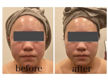 マリスレジーナ 新保店(MarisRegina)/コルギ