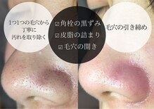 ボータン 恵(Beau Temps)