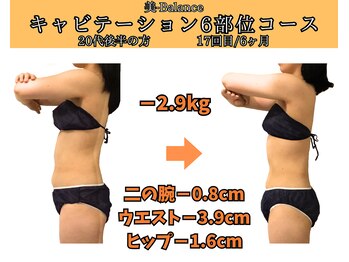 ビーバランス 本町店(美-Balance)/20代後半　月6部位コース
