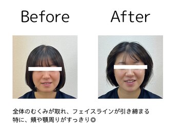 オリナ(olina)/-before & after-
