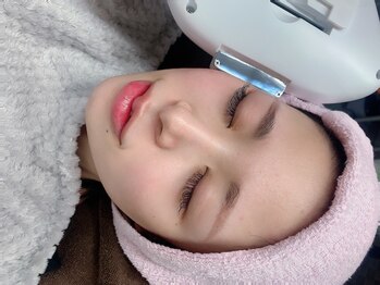 ブロンズ(BRONZE)の写真/【博多駅すぐ☆】お顔脱毛1回¥3300☆周りを気にせず、プライベート空間で施術可能♪都度払いOK◎