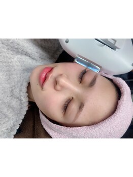 顔脱毛がしたい