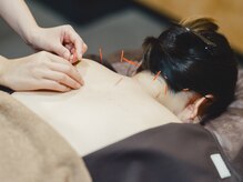 ファミリア鍼灸院 高田馬場(Familia鍼灸院)/オーダーメイドの施術