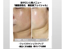 シェリングの雰囲気（しわたるみ改善!エイジングケアで顔のシミケア/ほうれい線小顔◎）