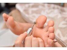 ラピスネイル(Lapis Nail)/【フットケア】美肌素足コース