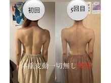 カシェット(cachette)/ブライダルエステ