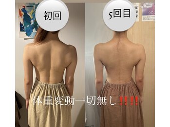 カシェット(cachette)/ブライダルエステ