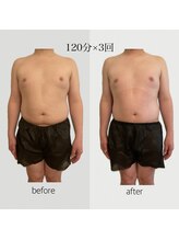 ファミーユ 名古屋店/【痩身ケア】ダイエット